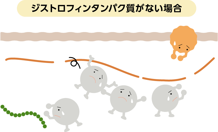 ジストロフィンタンパク質がない場合