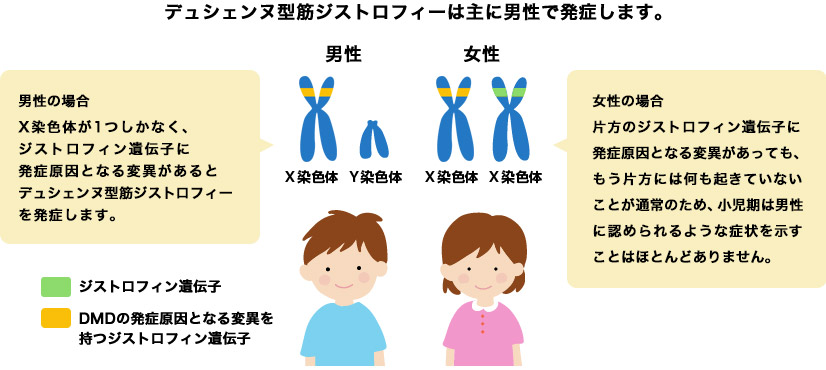 デュシェンヌ型筋ジストロフィーの症状は何ですか?
