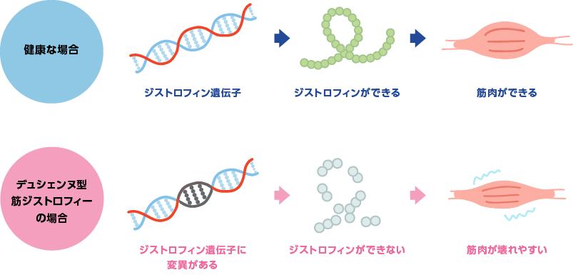 ジストロフィン遺伝子の変異