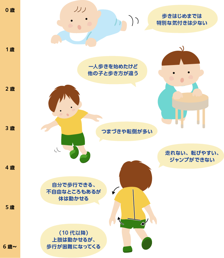 デュシェンヌ型筋ジストロフィーの症状 Dmdを知る 日本新薬株式会社 デュシェンヌ型筋ジストロフィーの症状 Dmdを知る 日本新薬株式会社