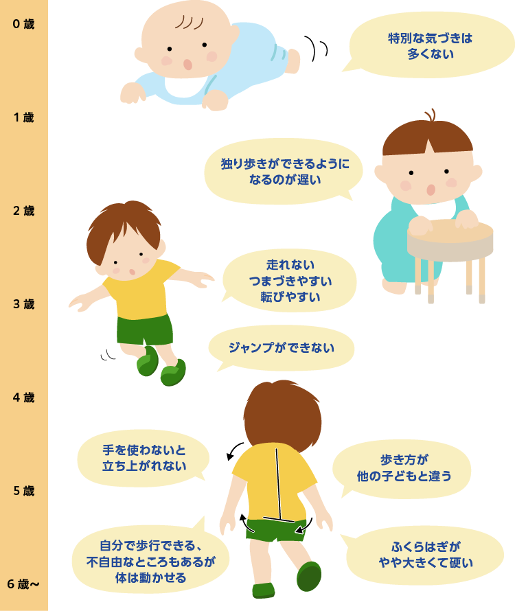 デュシェンヌ型筋ジストロフィーの症状 Dmdを知る 日本新薬株式会社