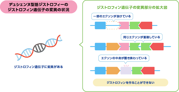 デュシェンヌ型筋ジストロフィーのジストロフィンの変異の状況