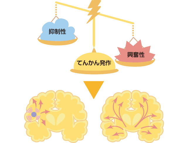 てんかん発作が起こる仕組み