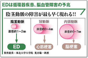 EDは循環器疾患、脳血管障害の予兆