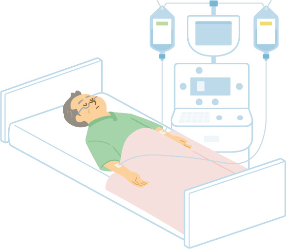 造血幹細胞移植の治療を受けている男性患者のイラスト