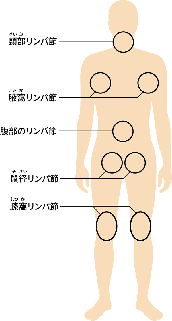 全身の主要なリンパ節の位置を示した図