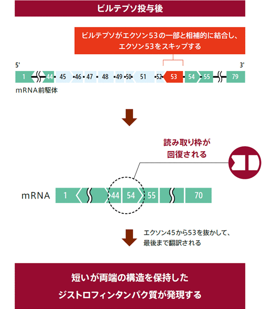 エクソンスキップ作用のイメージ図